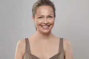 Smiling woman showcasing results from non-surgical facelift treatments, including dermal fillers and Botox for a youthful appearance.