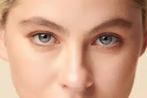 Close-up of a youthful eye area post-blepharoplasty, showing smooth skin and refreshed appearance.