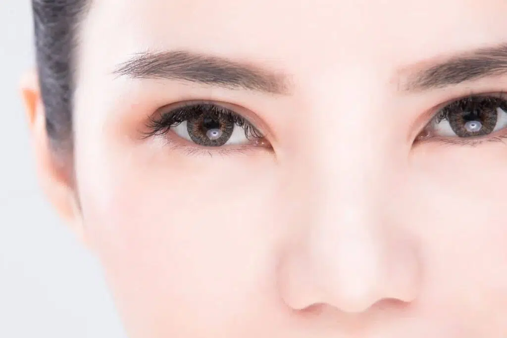 Brighten Tired Eyes: Is Lower Blepharoplasty Effective the Answer to Dark Circles? 1 Close-up of youthful eyes showing smooth under-eye area highlighting benefits of lower blepharoplasty procedure.