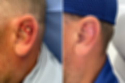 Reconstructive Surgery Before and After Photos in Freehold, NJ