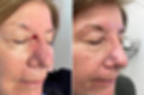 Reconstructive Surgery Before and After Photos in Freehold, NJ