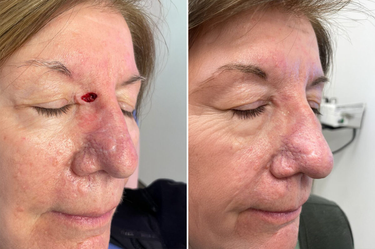 Reconstructive Surgery Before and After Photos in Freehold, NJ, Patient 5025