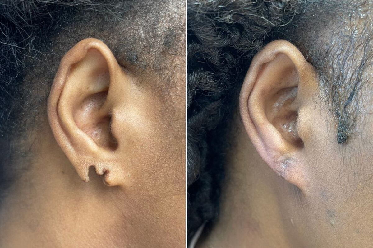 Patient 5053, Reconstructive Surgery Before and After Photos Reconstructive Surgery Before and After Photos in Freehold, NJ, Patient 5053