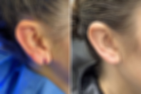 Reconstructive Surgery Before and After Photos in Freehold, NJ, Patient 5068