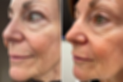 Reconstructive Surgery Before and After Photos in Freehold, NJ, Patient 5046