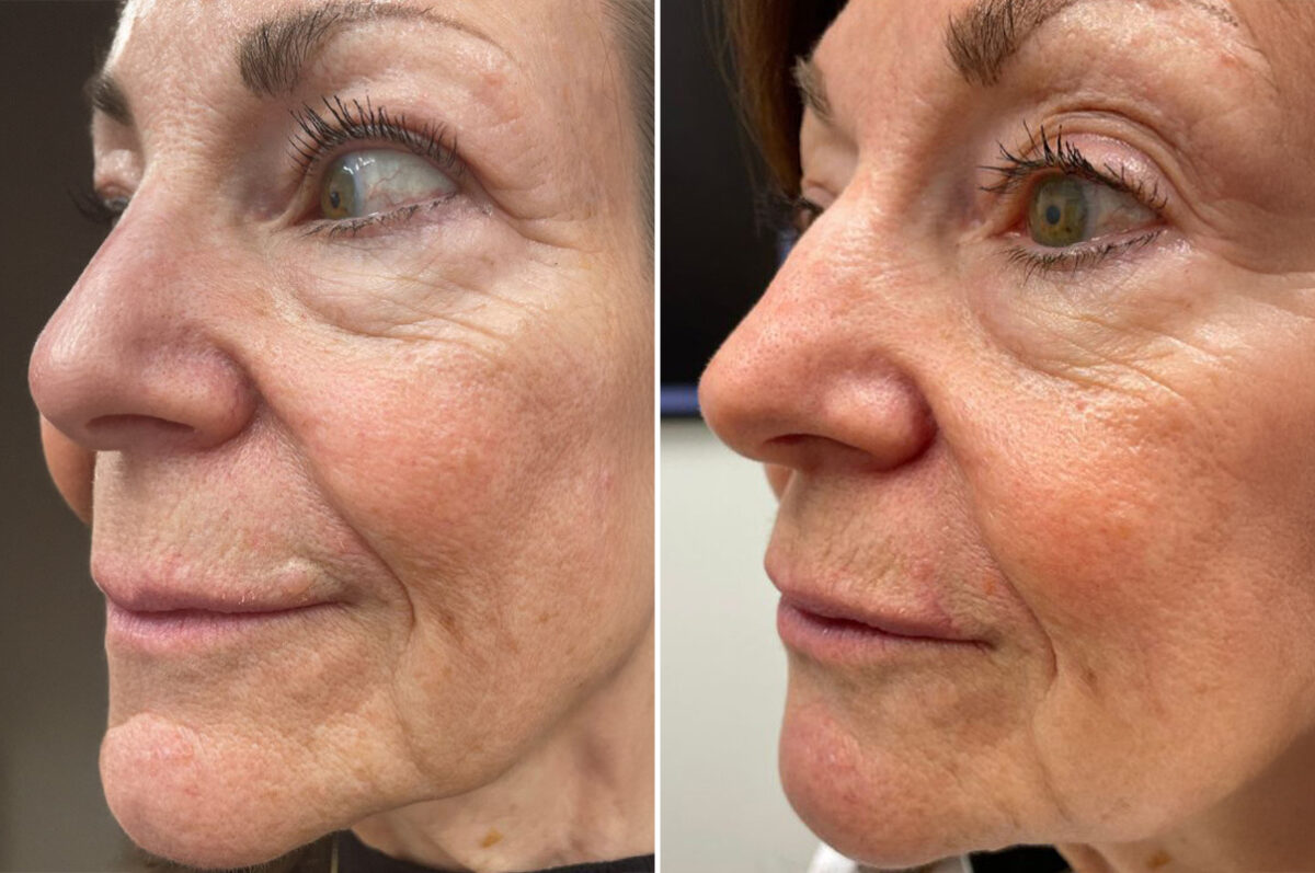 Patient 5046, Reconstructive Surgery Before and After Photos Reconstructive Surgery Before and After Photos in Freehold, NJ, Patient 5046