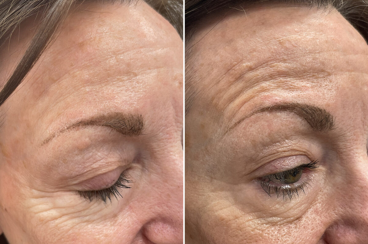 Patient 5046, Reconstructive Surgery Before and After Photos Reconstructive Surgery Before and After Photos in Freehold, NJ, Patient 5046