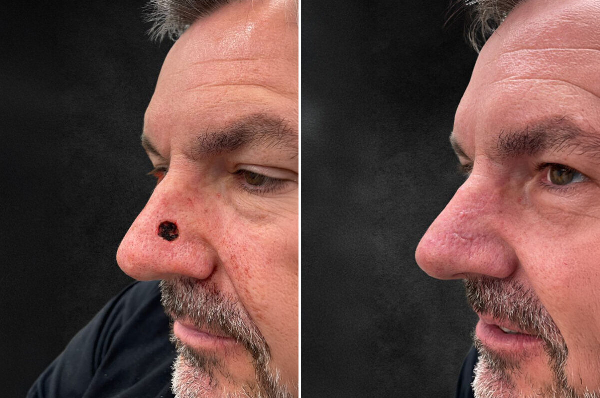 Reconstructive Surgery Before and After Photos in Freehold, NJ, Patient 5039