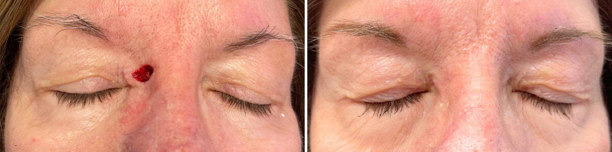 Reconstructive Surgery Before and After Photos in Freehold, NJ, Patient 5082