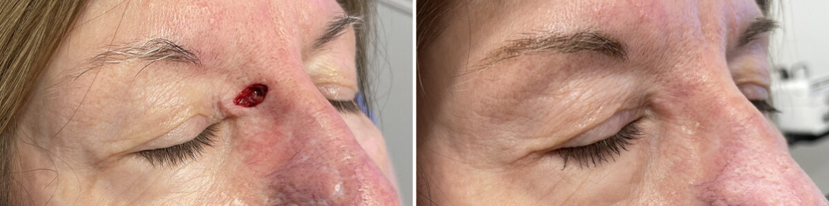 Reconstructive Surgery Before and After Photos in Freehold, NJ, Patient 5082